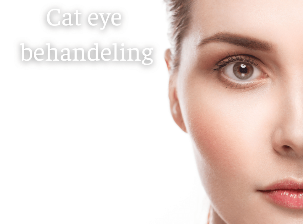 Cat eye behandeling